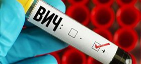 Что такое ВИЧ - инфекция?